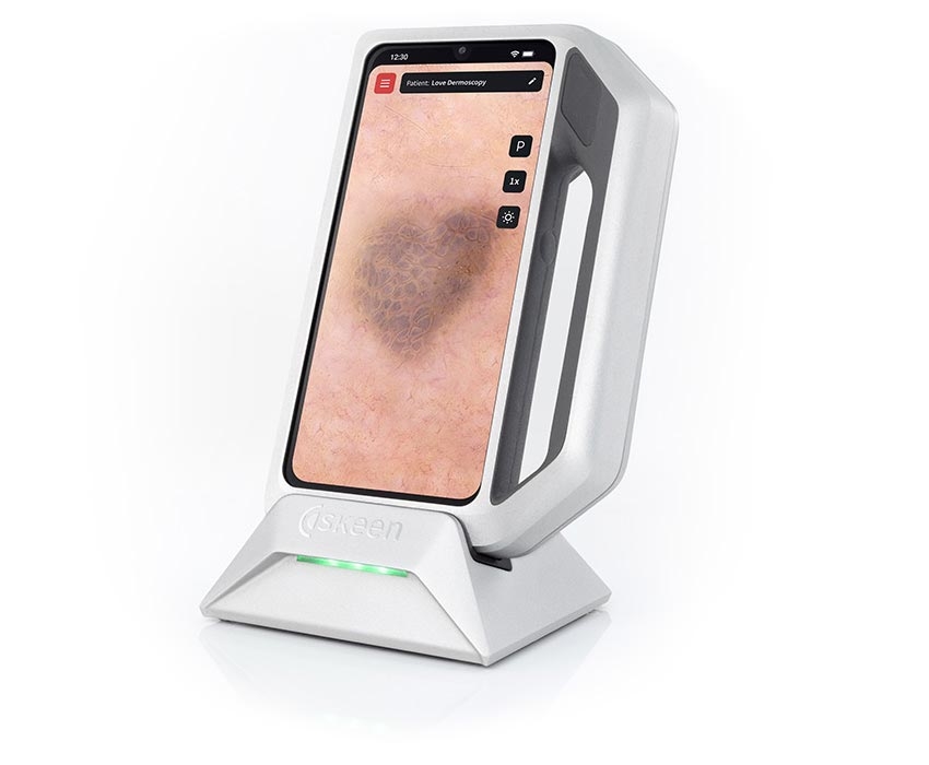 Máy soi chụp video da, tóc cầm tay FotoFinder Skeen - Công cụ cầm tay khó thiếu của bác sĩ da liễu chuyên nghiệp. Máy soi chụp video da, tóc cầm tay FotoFinder Skeen - Công cụ cầm tay khó thiếu của bác sĩ da liễu chuyên nghiệp.